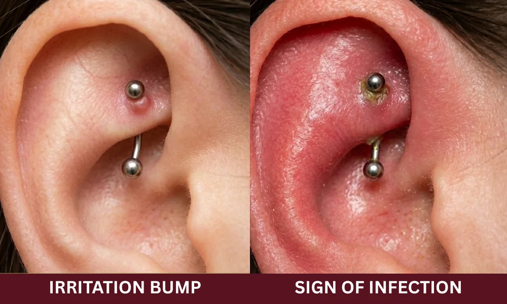 Rook Piercing Bump vs. Infection: How to Tell the Difference