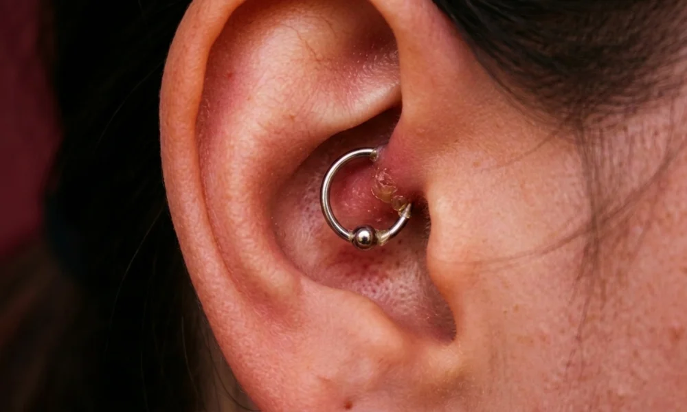 Daith Piercing Healing Stages Week by Week (Week 1 to Week 12)