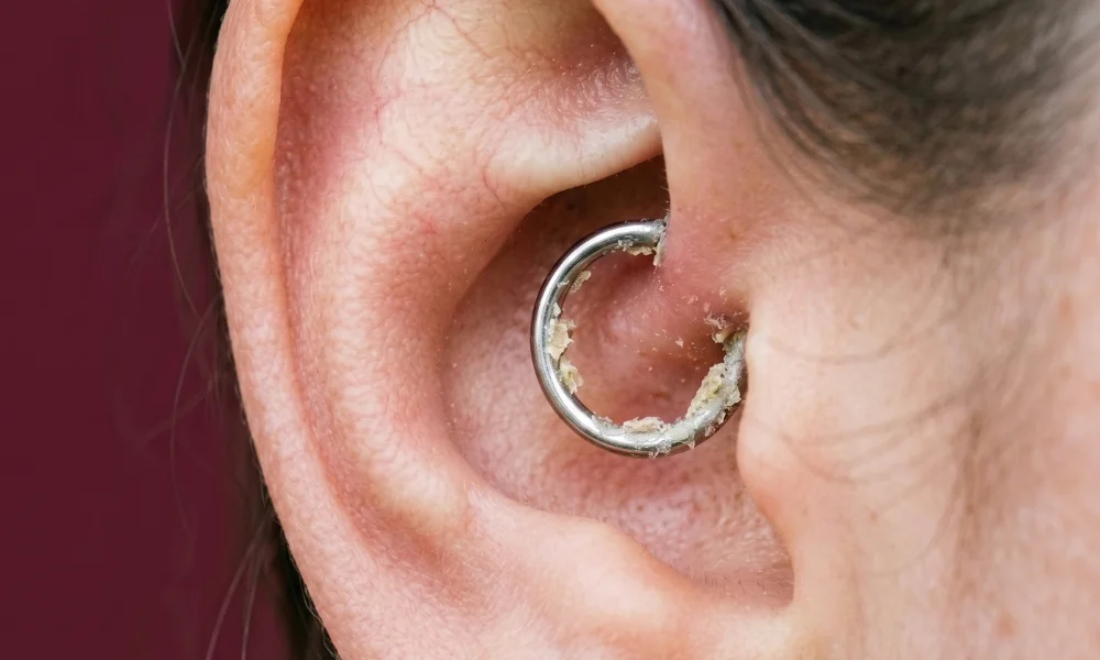 Daith Piercing Discharge Colors Chart: Yellow, White, Green & Clear