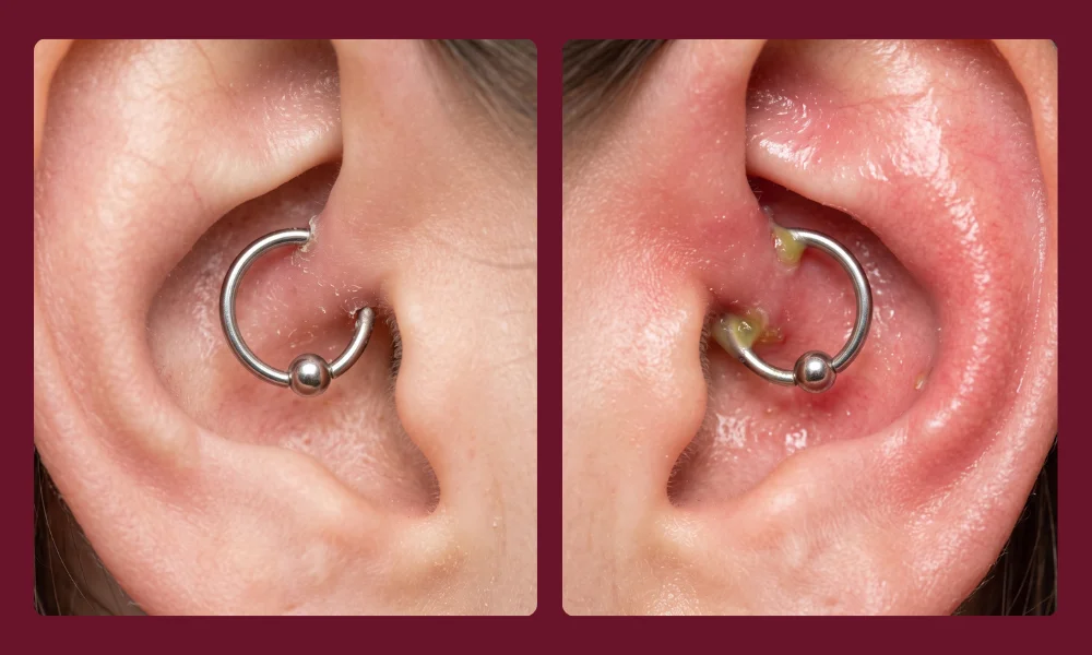 Itching vs Infection Piercing: How to Tell the Difference
