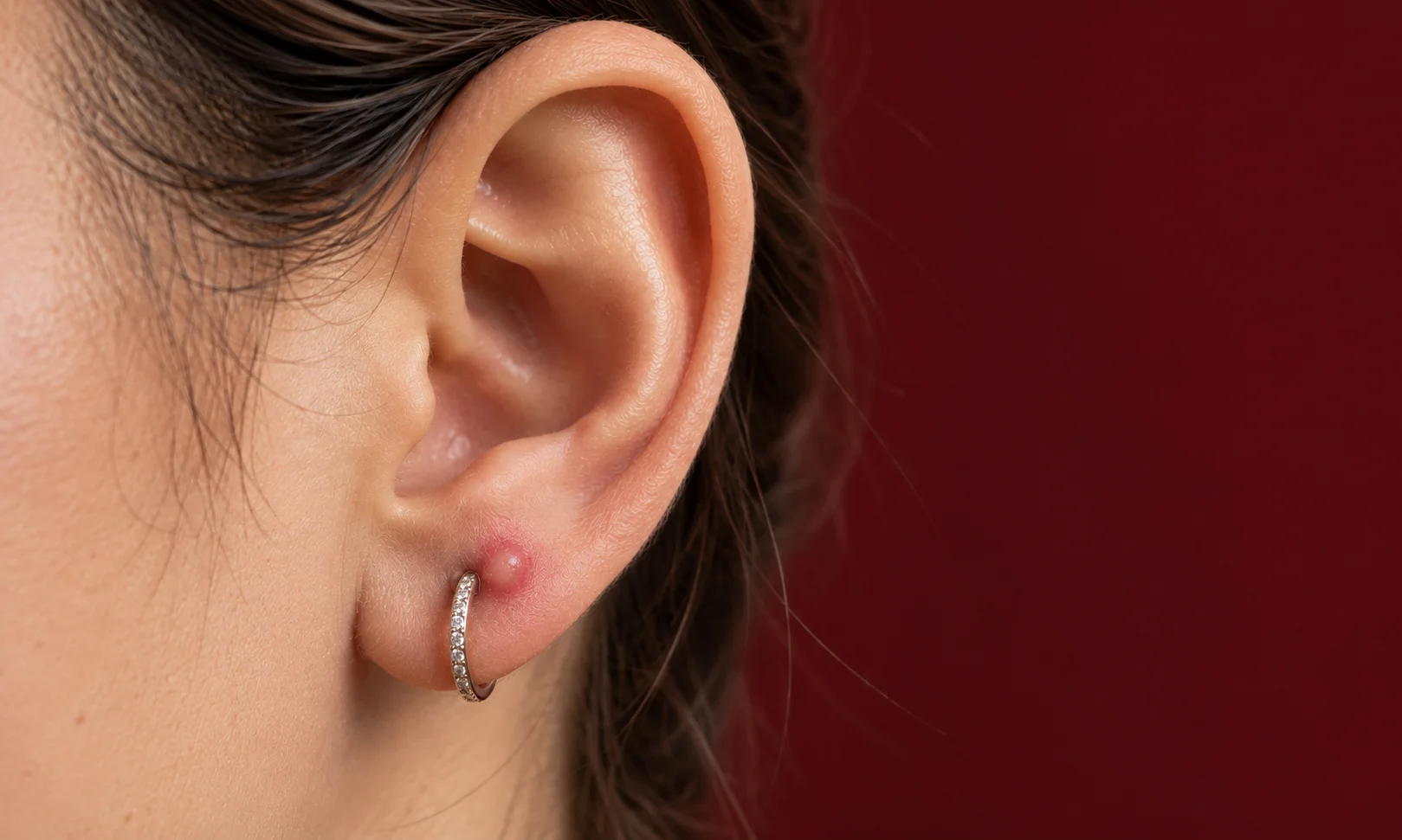 What Does an Irritation Bump Look Like?