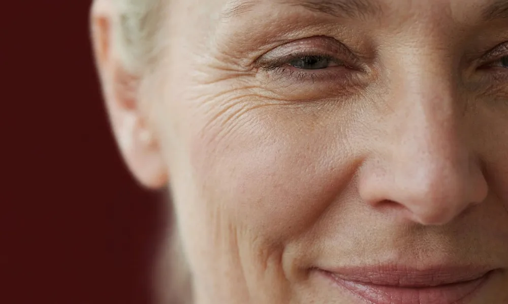 Why Do Fine Lines Show Up Around the Eyes?