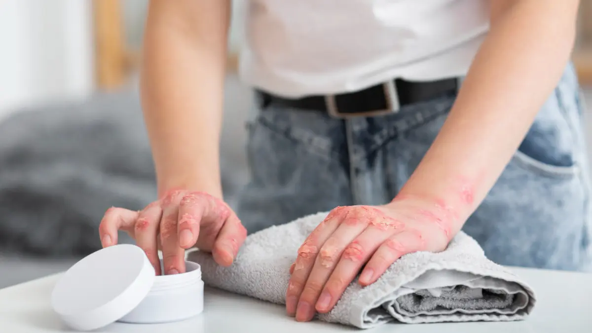 Skin Barrier Repair for Allergies: The 2026 Guide to Seasonal Skin Sensitivity